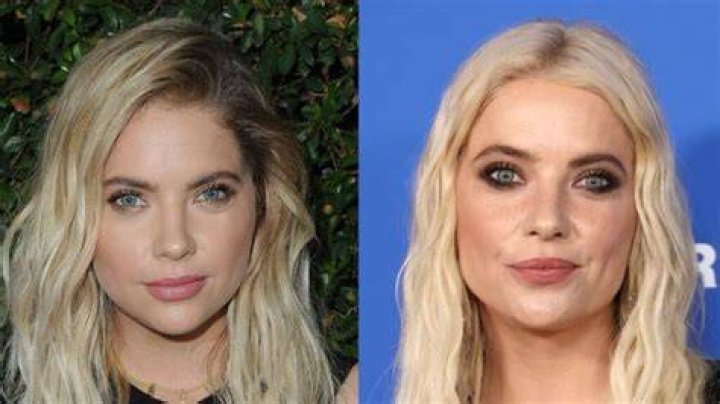 Ashley Benson Opens Up About Plastic Surgery Speculation: “She feels more confident and healthy”