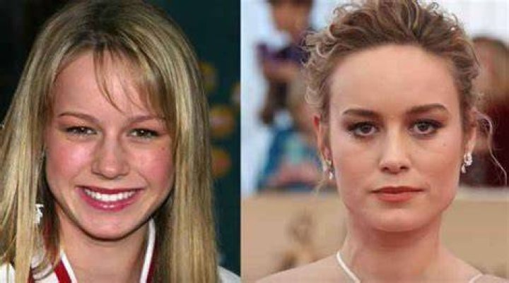 Brie Larson Plastic Surgery Before and After