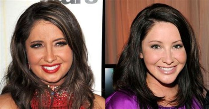 Bristol Palin Plastic Surgery Before and After