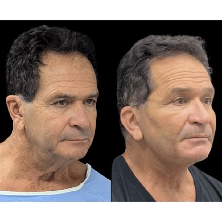 David Chiu, MD, Plastic Surgery, New York, NY, Lenox Hill Hospital