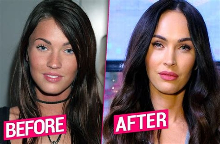 Megan Fox Plastic Surgery Before and After