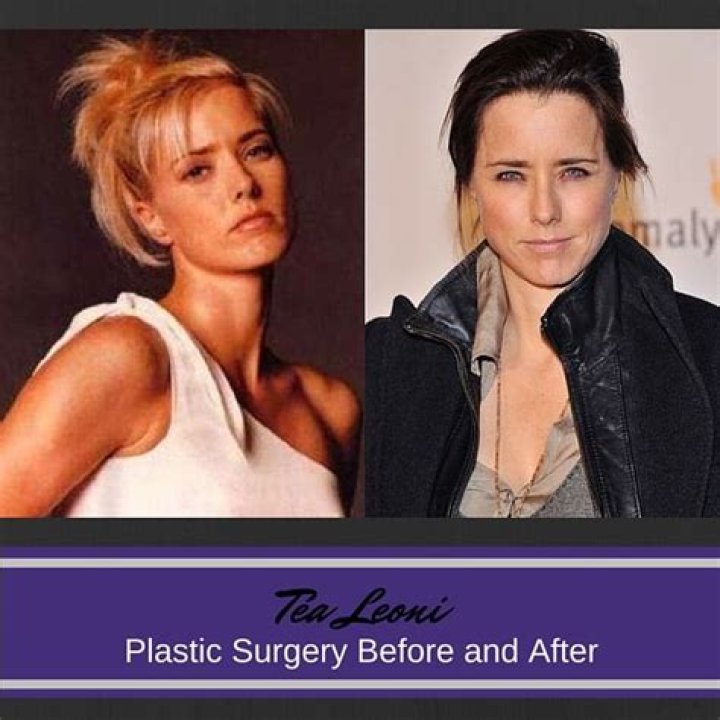 T&eacute;a Leoni Plastic Surgery Before and After